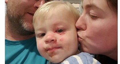 Balita Terluka Parah Diserang Pengidap Gangguan Jiwa