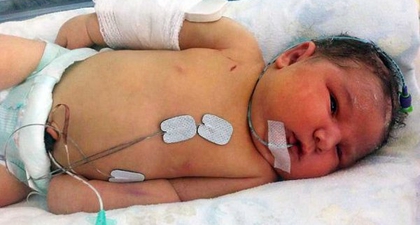 Bayi Dipatahkan Tangannya Agar Bisa Dilahirkan