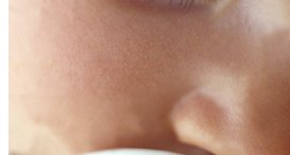 Bolehkah Si Kecil Mengempeng?