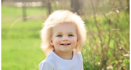 Bayi Ini Punya Rambut ‘Jabrik’ Langka