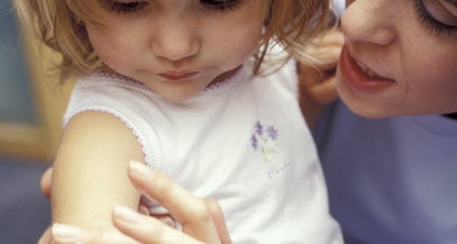 Penanganan Cacar Air Pada Si Kecil (2)