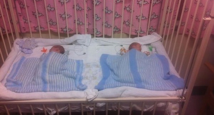 Si Kembar dengan Twin to Twin Transfusion Syndrome Bertahan Hidup