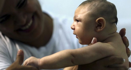 Virus Zika Sebabkan Kelainan Mata pada Bayi