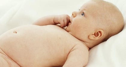 Hernia Umbilikal pada Bayi