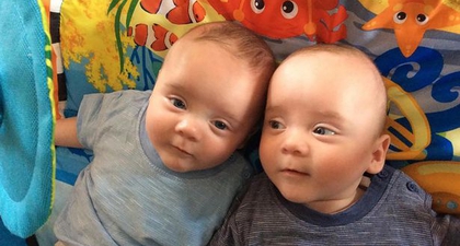 Si Kembar dengan Twin to Twin Transfusion Syndrome