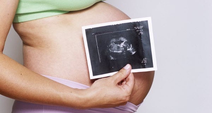 Diagnosa Placenta Accreta (2) 