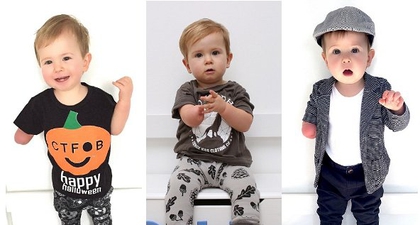 Balita Bertangan Satu Tampil Stylish di Instagram