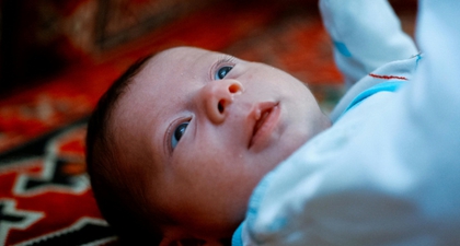 5 Cara Menghilangkan Bintik Merah pada Bayi secara Alami