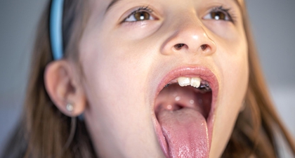 Mulut Anak Penuh Sariawan? Kenali Penyebab dan Solusinya