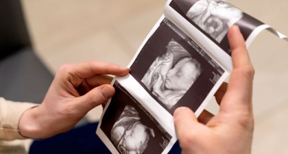 Periksakan Secara Teratur, Ini 7 Tanda Janin Sehat Trimester 1