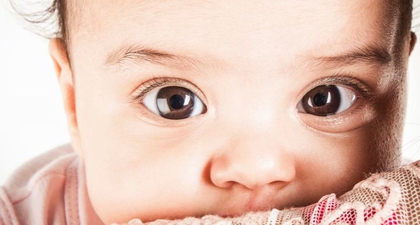 Waspada Strabismus, Kondisi Mata Juling yang Memengaruhi Penglihatan Anak