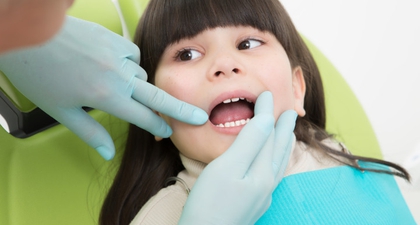 Mengatasi White Spot Gigi Anak, Bercak Putih yang Muncul Tanpa Sadar