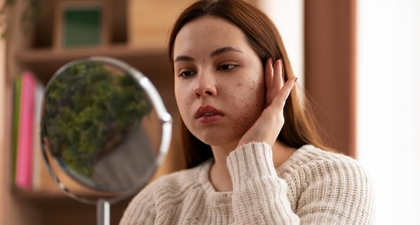 8 Ciri Kulit Tidak Cocok dengan Produk Skincare yang Dipakai