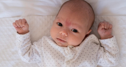 7 Rekomendasi Krim untuk Menghilangkan Bintik Merah pada Bayi