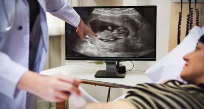Ciri-Ciri Janin Sehat di Trimester Pertama yang Perlu Ibu Hamil Ketahui