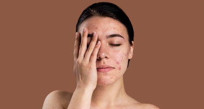 7 Tips Menghilangkan Bruntusan di Jidat dengan Cara Alami dan Efektif