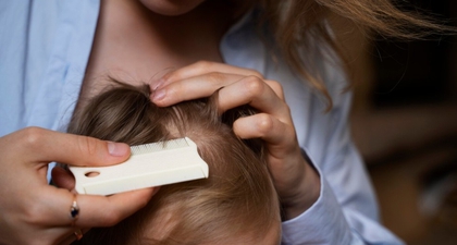 5 Cara Menghilangkan Ketombe pada Bayi