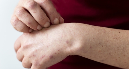 7 Jenis Penyakit Kulit yang Bisa Diderita Anak