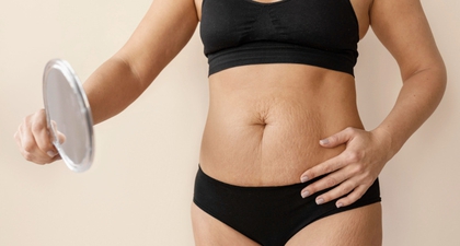 Kenapa Perut Hitam Setelah Melahirkan? Ini Penyebab dan Cara Mengatasinya