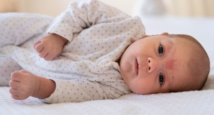 Infeksi Kulit pada Bayi, Ini Penyebab dan Cara Mencegahnya