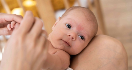 Kulit Wajah Si Kecil Kurang Kelembapan? Waspada Awal Gejala Dermatitis Atopik