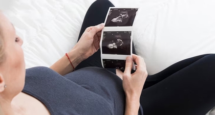 Keluar Flek saat Hamil Muda, Ini Penyebabnya