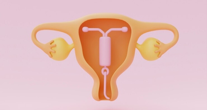 Kapan IUD Harus Diganti? Ini Penjelasannya, Moms