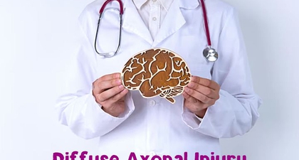 Mengenal Cedera Otak Diffuse Axonal Injury (DAI), Bisa Sembuh Lagi?