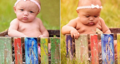Bayi Kembar Ini Sangat Berbeda
