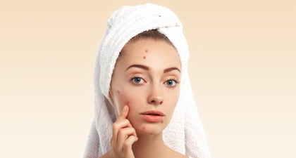 5 Acne Patch untuk Atasi Jerawat Tanpa Ganggu Penampilan