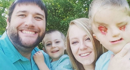 Viral, Anak 6 Tahun Ini Hidup Tanpa Mata