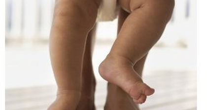 Kelainan Bentuk Kaki Bayi (2)