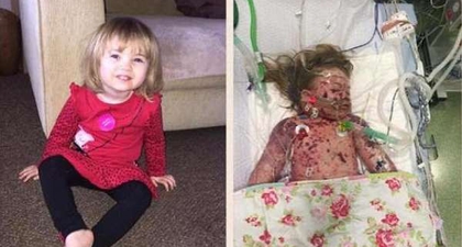 Waspada! Meningitis Banyak Menyerang Anak-anak