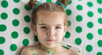 Kenali Gejala Cacar Ular pada Anak dan Cara Mengatasinya