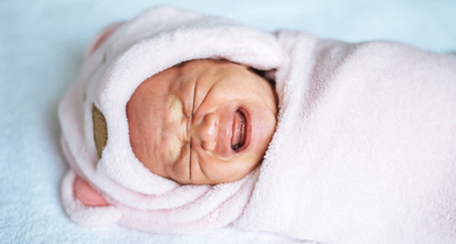 Mengenal Phocomelia, Anak Lahir dengan Anggota Tubuh Pendek