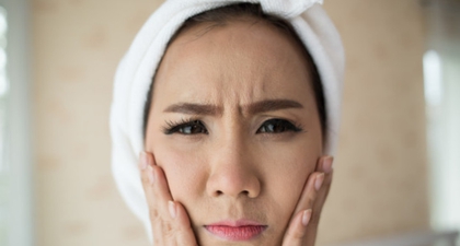 Ini Penyebab Kulit Wajah Berminyak dan Cara Mengatasinya